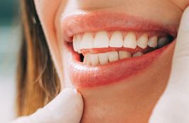 Zubni implanti u Novom Sadu - svetska usluga po povoljnoj ceni