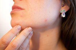 Koliko su prirodni proizvodi za negu kože zaista bezbedni