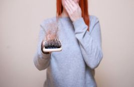 Opadanje kose u doba korone – zašto se dešava, šta treba da radite i kome da se obratite za pomoć
