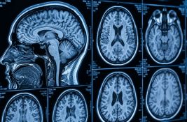 Nova veštačka inteligencija može da otkrije o čemu razmišljate na osnovu snimka mozga