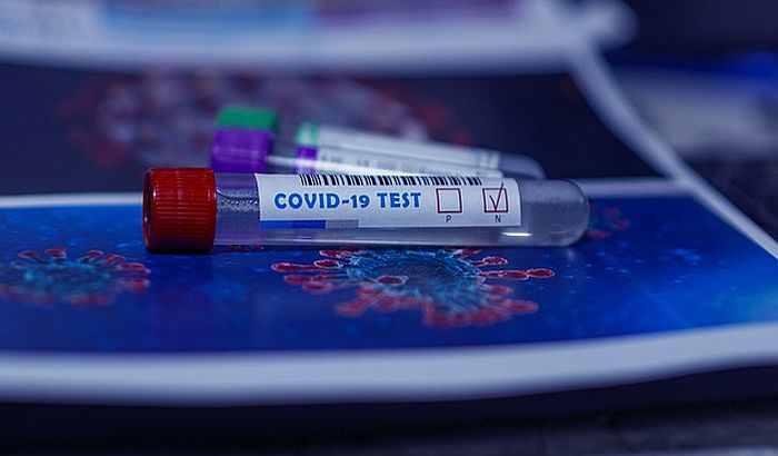 Austrija uvodi PCR test za boravak u bolnici, rezervaciju hotela ili odlazak u pozorište