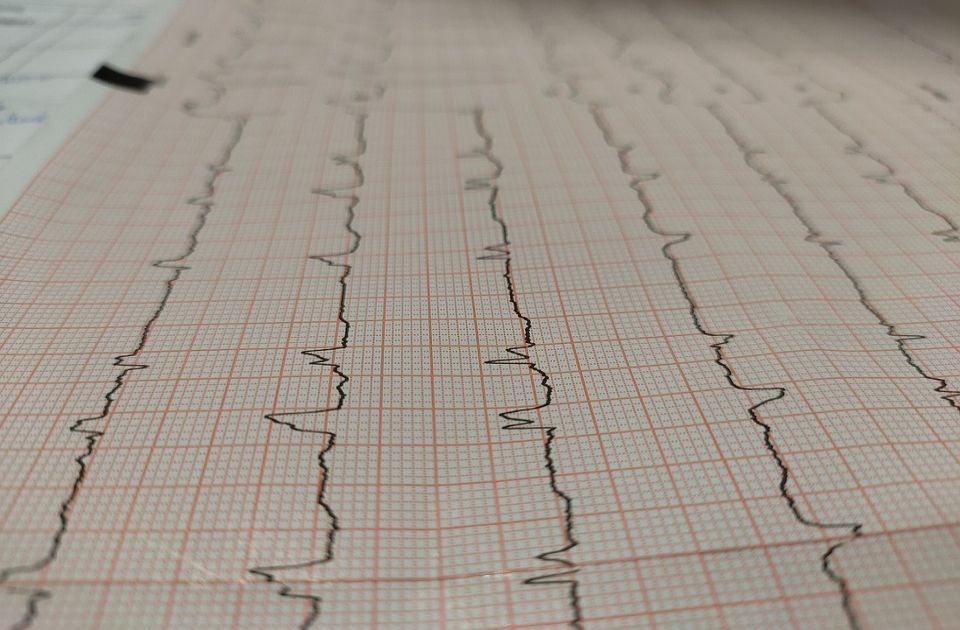 Kardiolog objasnio koje četiri greške zimi mogu dovesti do srčanog udara