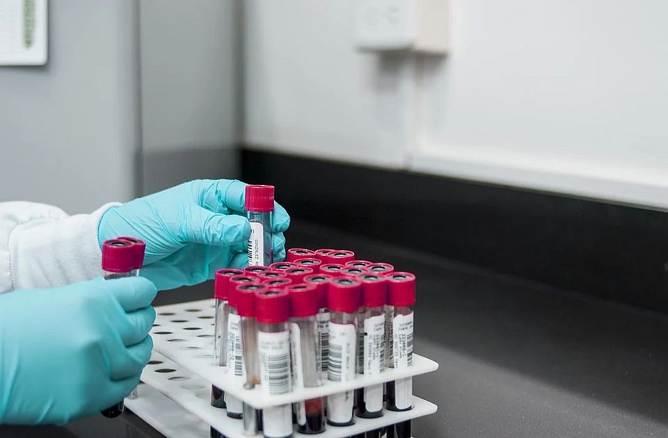Fajzer dobio odobrenje u SAD za novu genetsku terapiju protiv hemofilije