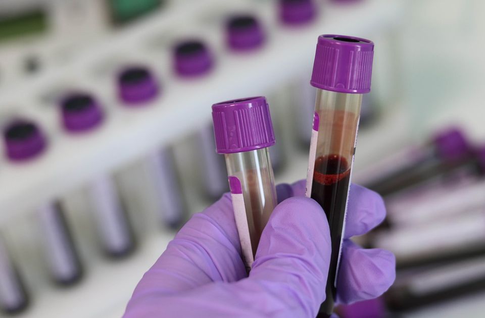Mikroplastika prvi put pronađena u ljudskoj krvi