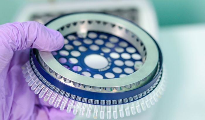 Cveta prodaja lažnih PCR testova širom sveta, slučajevi i u Srbiji