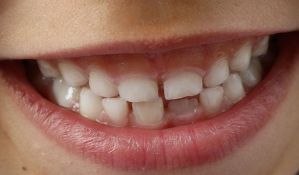 Istraživanje: Obrazovaniji roditelji imaju zdraviju decu