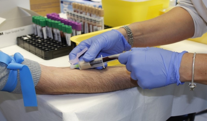 Pozivaju se dobrovoljni davaoci sa negativnim Rh faktorom da daju krv