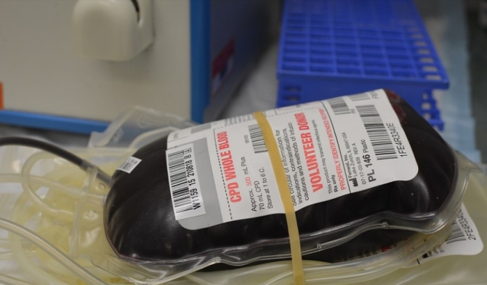 Traže se dobrovoljni davaoci krvi sa negativnim Rh faktorom
