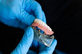 Šta vam je sve potrebno za negu zubnog implanta?