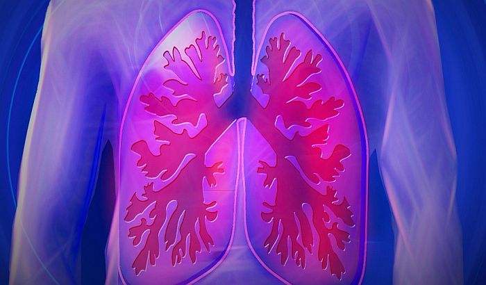 Na vidiku nove metode u lečenju raka pluća