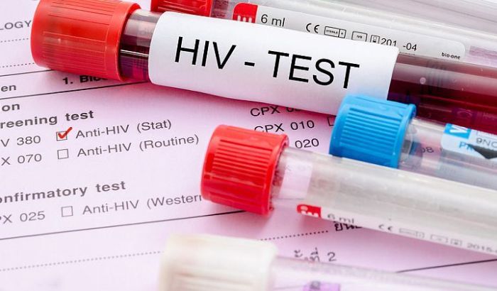 Vakcina protiv HIV daje rezultate, počela testiranja na majmunima