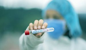 Koliko koštaju PCR testovi u komšiluku?