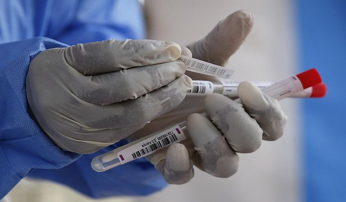 Za ulazak u Kanadu neophodan negativan test na koronu