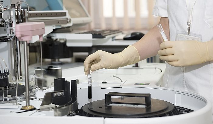 Institut: Nismo uočili pad broja antitela kod obolelih od korone