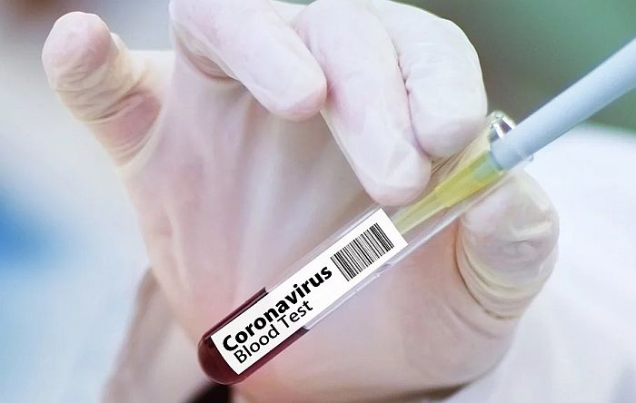 Počinje testiranje na virus korona na lični zahtev, cena 6.000 dinara