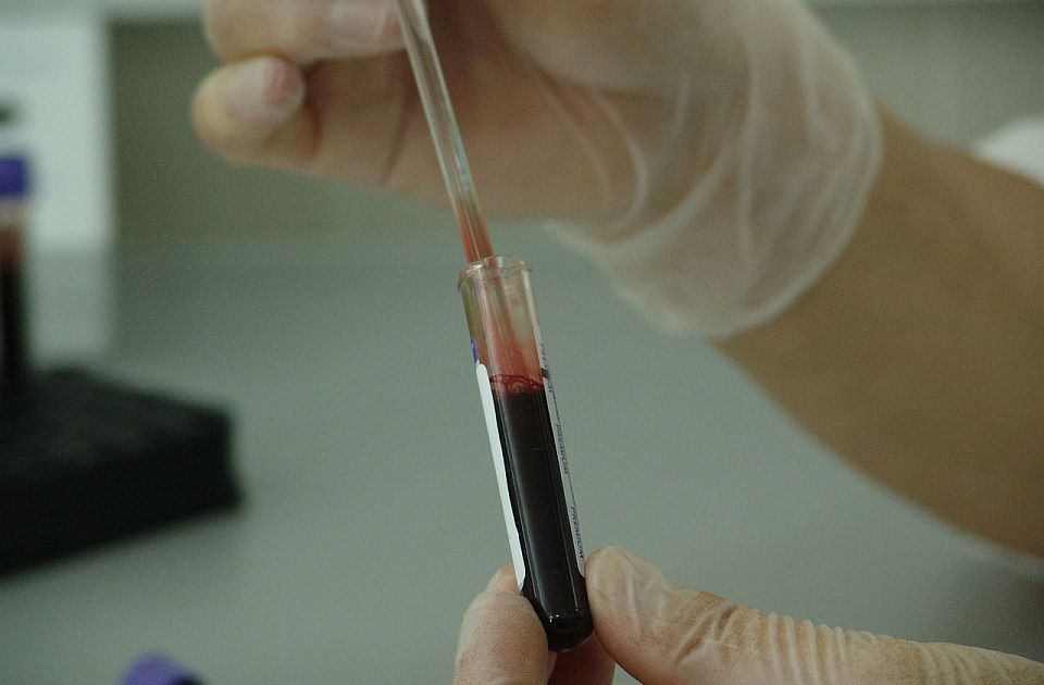 Svi koji danas daju krv u Zavodu za tranfuziju u Novom Sadu besplatno dobijaju analize