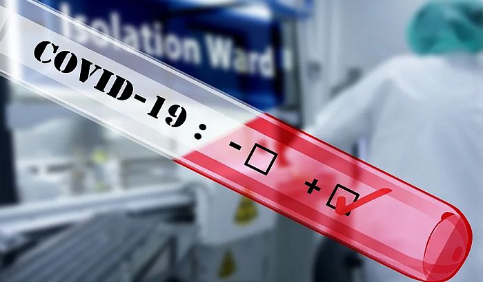 U Beogradu za testiranje na koronu na lični zahtev nema termina do 20. avgusta