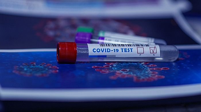 Za razvoj i proizvodnju domaćih ELISA testova 113,2 miliona dinara