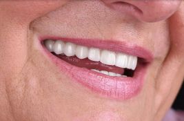 Cveta dentalni turizam: Stranci u sve većem broju u Novom Sadu popravljaju zube