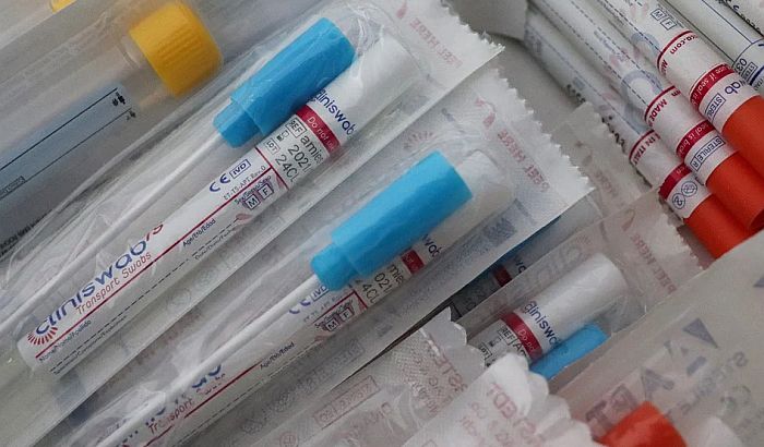 U Srbiji se razvija domaći antigenski test na korona virus