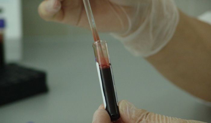 Simptomi anemije najizraženiji u proleće Simptomi anemije najizraženiji u proleće