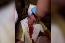 VIDEO Poslanik SSP Peđa Mitrović udaren šipkom u glavu na protestu u Beogradu