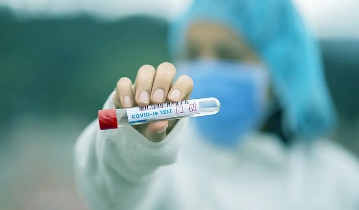 U svetu od korone umrlo najmanje 2,7 miliona ljudi