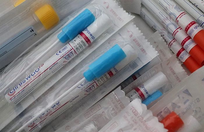 Srbija do kraja aprila dobija svoj serološki test na antitela