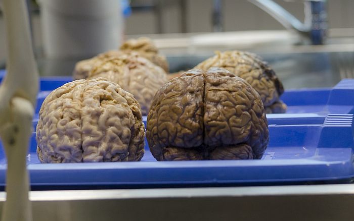 Mozak radi još najmanje deset minuta nakon smrti pacijenta