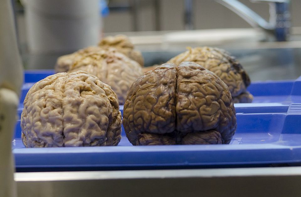 VIDEO: U jednom podrumu u Danskoj nalazi se skoro 1.000 ljudskih mozgova