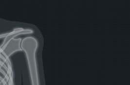 Na današnji dan: Rentgen otkrio x-zrake