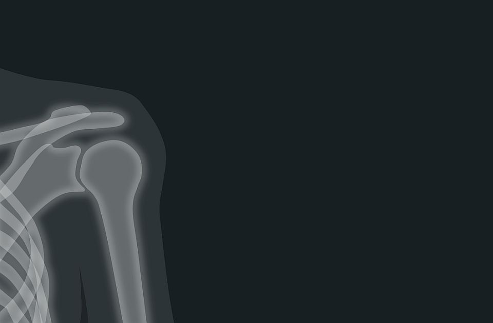 Na današnji dan: Rentgen otkrio x-zrake