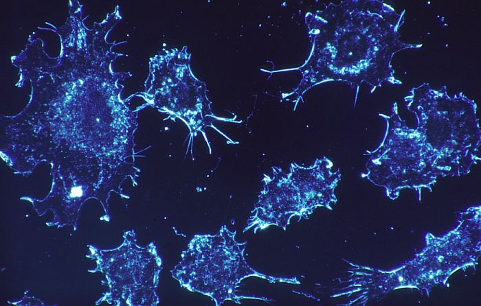 Otkriven protein koji usporava razvoj raka jetre