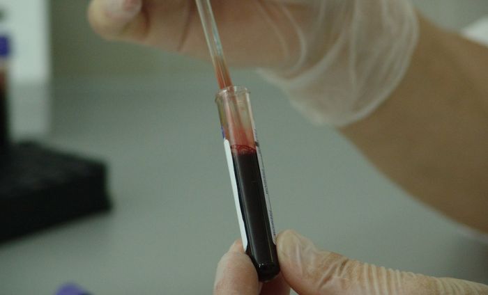 Namerno HIV-om zarazio više od 30 žena