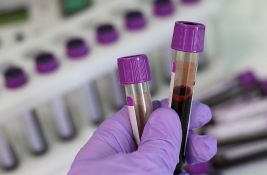 Razvijen jeftin test krvi koji otkriva 14 vrsta kancera u ranoj fazi