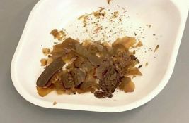 Naučnici potvrdili: Stari Rimljani su zaista koristili izmet kao lek