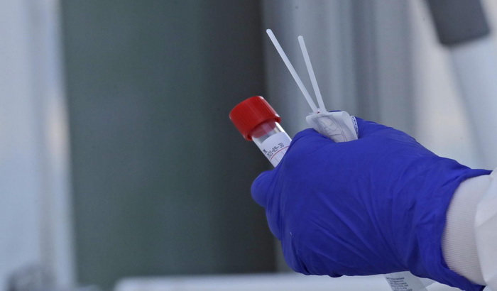 Lekarka u Rusiji privedena jer sumnja u zvanične podatke o broju obolelih od virusa korona