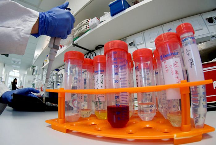 Naučnici razvijaju test krvi koji može da otkrije više vrsta karcinoma