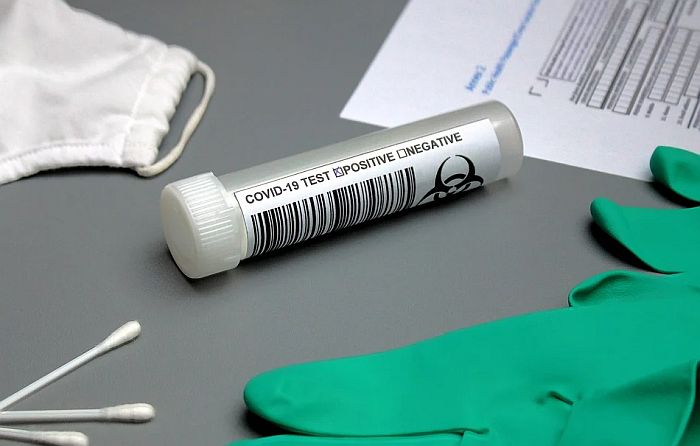 Državljani Srbije od sutra mogu na Kipar uz negativan PCR test