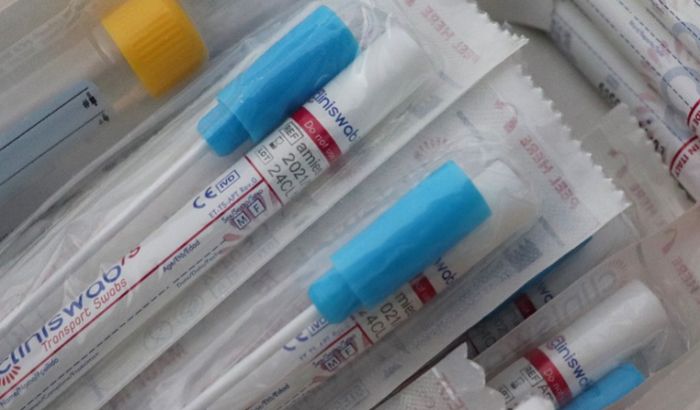 U Sloveniji od danas brzo testiranje na pet graničnih prelaza sa Hrvatskom