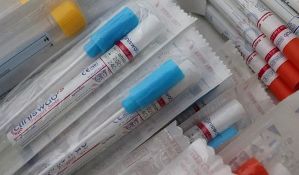 U Vojvodini najmanje građana sa razvijenim imunitetom na korona virus