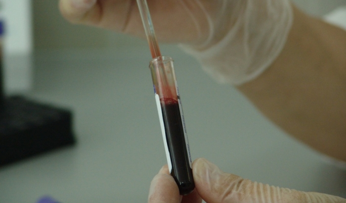 Procedura testiranja antitela na korona virus na lični zahtev