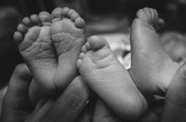 Veoma retka pojava: Splitske bliznakinje rođene u različitim godinama