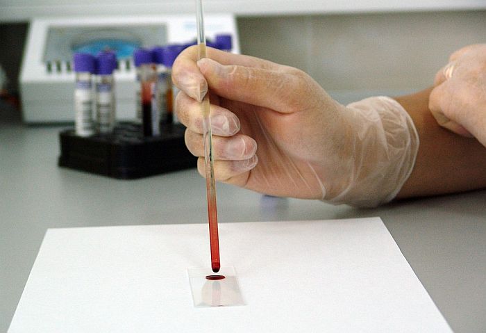 Institut u Kragujevcu nedelju dana ne radi PCR analize, aparat na servisiranju