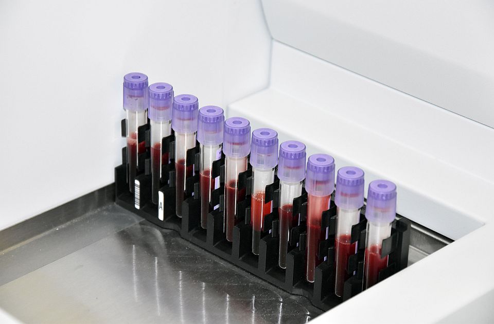 Laboratorijske analize u starijem dobu: Koji nalazi su važni i kako pravilno tumačiti rezultate