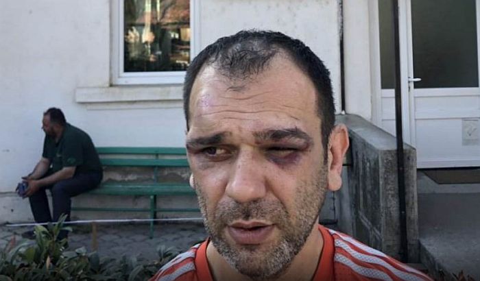 Organizator protesta tvrdi da su ga pretukli u kancelariji predsednika opštine Žitorađa, SNS demantuje