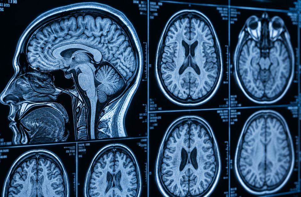 Nova veštačka inteligencija može da otkrije o čemu razmišljate na osnovu snimka mozga