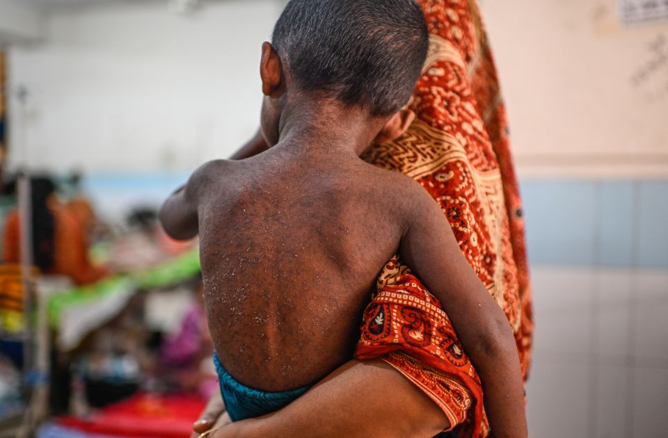 Epidemija malih boginja u Bangladešu:Desetine hiljada zaraženih i gotovo 1.000 mrtvih